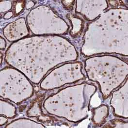 Immunohistochemistry (Formalin/PFA-fixed paraffin-embedded sections) - Anti-UNC119-binding protein C5orf30 antibody (AB150906)