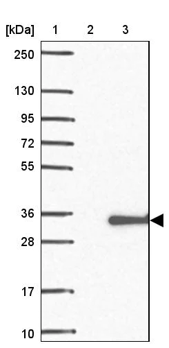 Western blot - Anti-UNC119-binding protein C5orf30 antibody (AB150906)