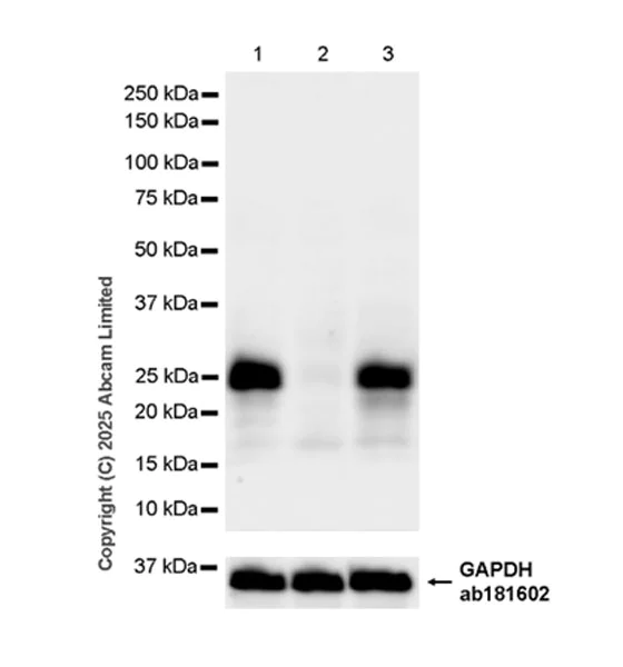 Western blot - Anti-UNC119-binding protein C5orf30 antibody [EPR30038-27] (AB324867)