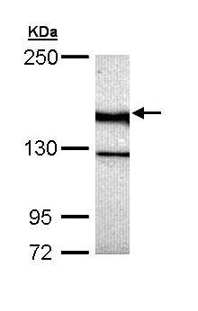Western blot - Anti-UNC13B antibody (AB97664), expandable thumbnail