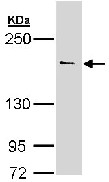 Western blot - Anti-UNC13B antibody (AB97924)