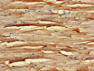Immunohistochemistry (Formalin/PFA-fixed paraffin-embedded sections) - Anti-UNC45B antibody (AB234730)
