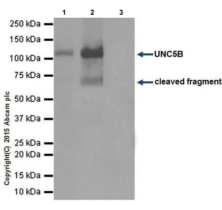 Immunoprecipitation - Anti-UNC5B antibody [EPR18439] (AB189914)