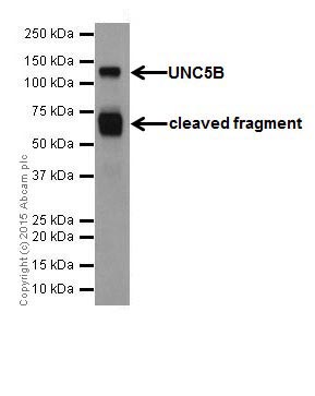 Western blot - Anti-UNC5B antibody [EPR18439] (AB189914)