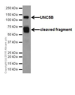 Western blot - Anti-UNC5B antibody [EPR18439] (AB189914)