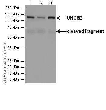 Western blot - Anti-UNC5B antibody [EPR18439] (AB189914)