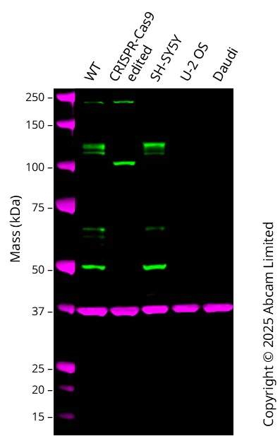 Western blot - Anti-UNC5B antibody [EPR26173-186] (AB313565)