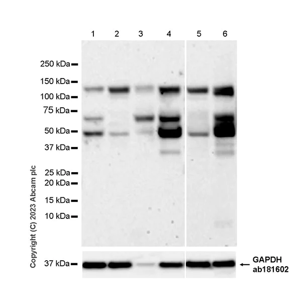 Western blot - Anti-UNC5B antibody [EPR26173-186] - BSA and Azide free (AB313566)