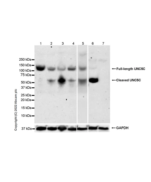 Western blot - Anti-UNC5C antibody [EPR24190-37] (AB302924)