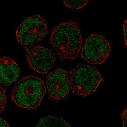 Immunocytochemistry/ Immunofluorescence - Anti-UNCX antibody (AB221353)