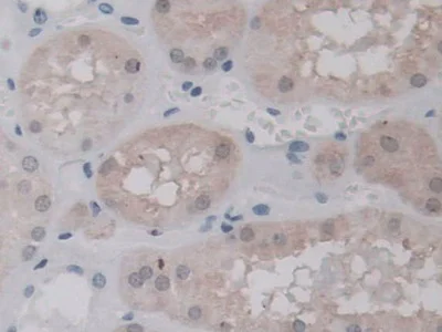 Immunohistochemistry (Formalin/PFA-fixed paraffin-embedded sections) - Anti-UNG antibody (AB233206)