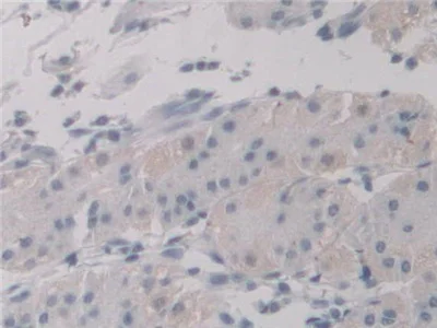 Immunohistochemistry (Formalin/PFA-fixed paraffin-embedded sections) - Anti-UNG antibody (AB233206)