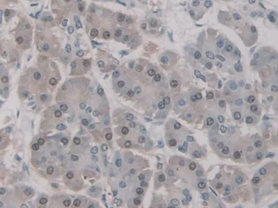Immunohistochemistry (Formalin/PFA-fixed paraffin-embedded sections) - Anti-UNG antibody (AB233206)