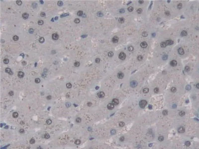 Immunohistochemistry (Formalin/PFA-fixed paraffin-embedded sections) - Anti-UNG antibody (AB233206)