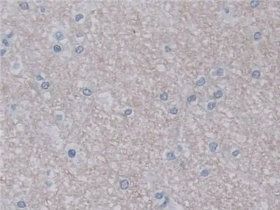 Immunohistochemistry (Formalin/PFA-fixed paraffin-embedded sections) - Anti-UNG antibody (AB233206)