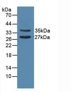 Western blot - Anti-UNG antibody (AB233206)