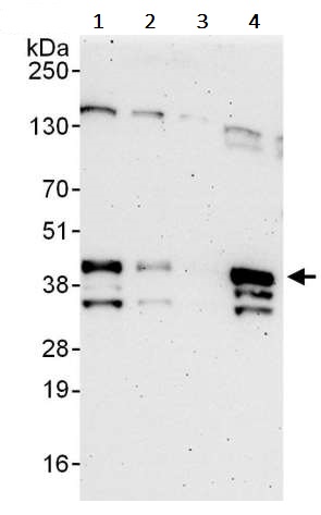 Western blot - Anti-UNG antibody (AB245630), expandable thumbnail