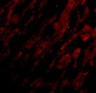 Immunocytochemistry/ Immunofluorescence - Anti-UNG antibody (AB47680)