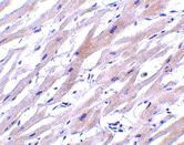 Immunohistochemistry (Formalin/PFA-fixed paraffin-embedded sections) - Anti-UNG antibody (AB47680)