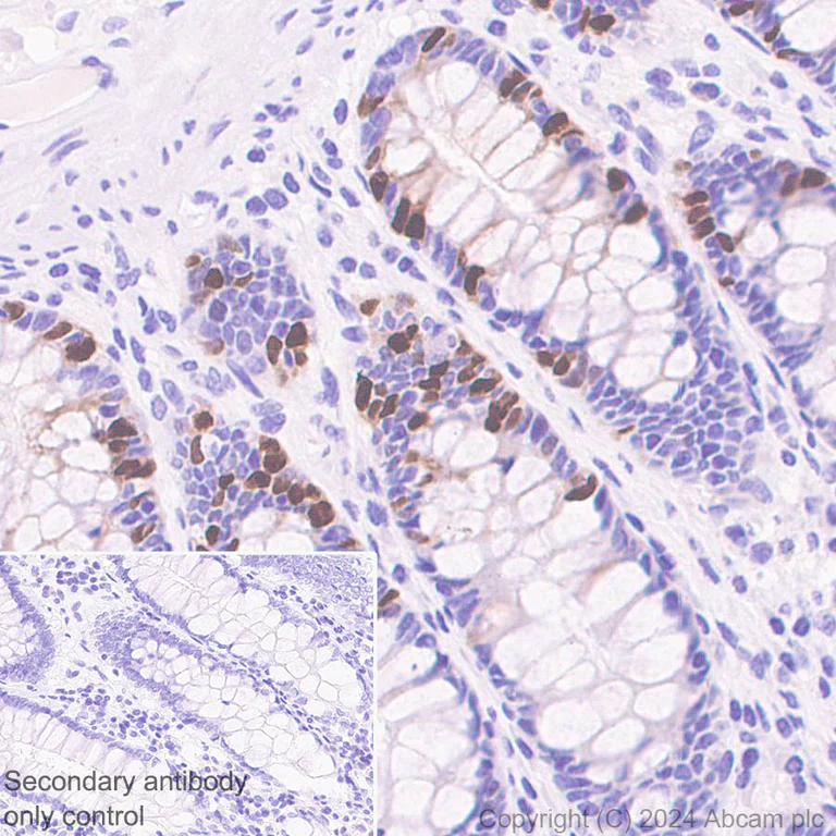 Immunohistochemistry (Formalin/PFA-fixed paraffin-embedded sections) - Anti-UNG2 antibody [EPR29004-78] - BSA and Azide free (AB318983)