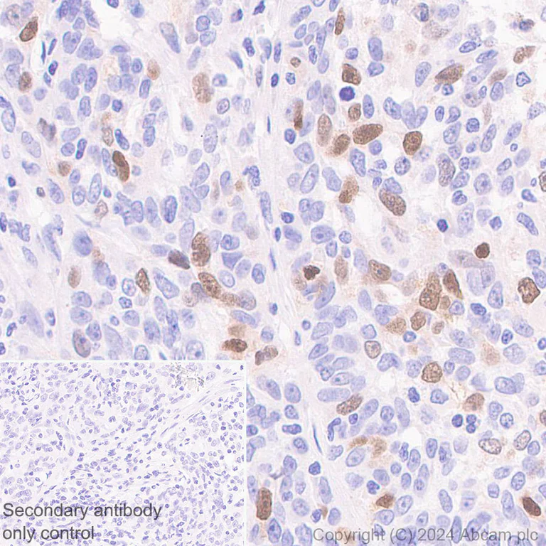 Immunohistochemistry (Formalin/PFA-fixed paraffin-embedded sections) - Anti-UNG2 antibody [EPR29004-78] - BSA and Azide free (AB318983)
