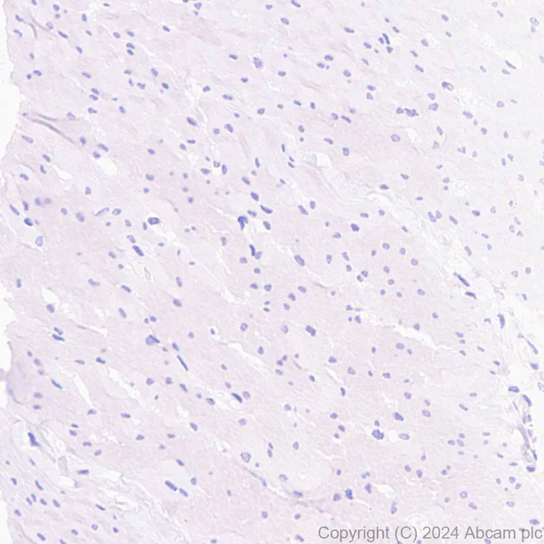 Immunohistochemistry (Formalin/PFA-fixed paraffin-embedded sections) - Anti-UNG2 antibody [EPR29004-78] - BSA and Azide free (AB318983)