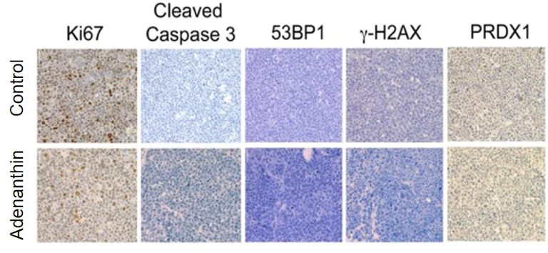 Immunohistochemistry (Formalin/PFA-fixed paraffin-embedded sections) - Universal HIER antigen retrieval reagent (10X) (AB208572)