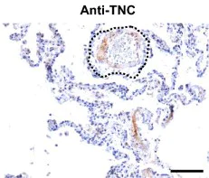 Immunohistochemistry (Formalin/PFA-fixed paraffin-embedded sections) - Universal HIER antigen retrieval reagent (10X) (AB208572)