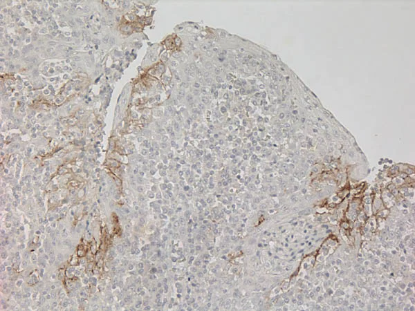 Immunohistochemistry - Universal HIER antigen retrieval reagent (10X) (AB208572)