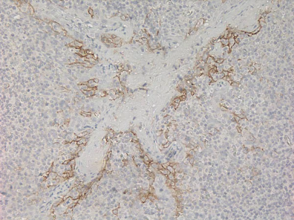 Immunohistochemistry - Universal HIER antigen retrieval reagent (10X) (AB208572)