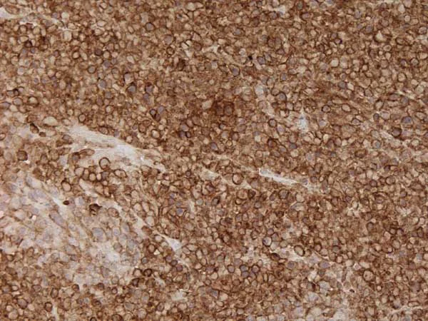 Immunohistochemistry - Universal HIER antigen retrieval reagent (10X) (AB208572)