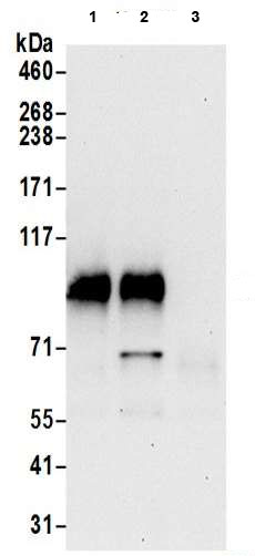 Immunoprecipitation - Anti-UNK unkempt antibody (AB205021)
