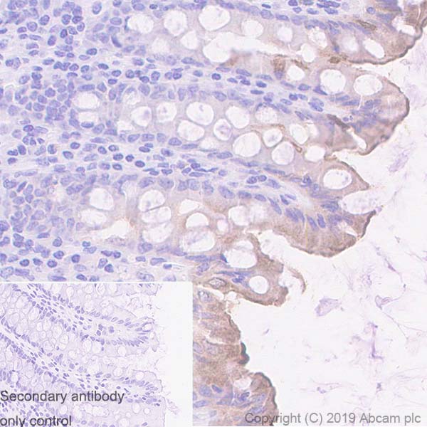 Immunohistochemistry (Formalin/PFA-fixed paraffin-embedded sections) - Anti-UNQ511 antibody [EPR23557-128] (AB270397), expandable thumbnail