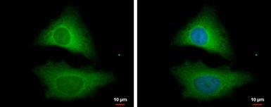 Immunocytochemistry/ Immunofluorescence - Anti-Unrip antibody (AB102001)