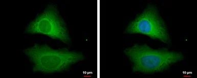 Immunocytochemistry/ Immunofluorescence - Anti-Unrip antibody (AB102001)