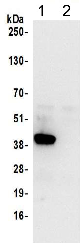 Immunoprecipitation - Anti-Unrip antibody (AB205015)
