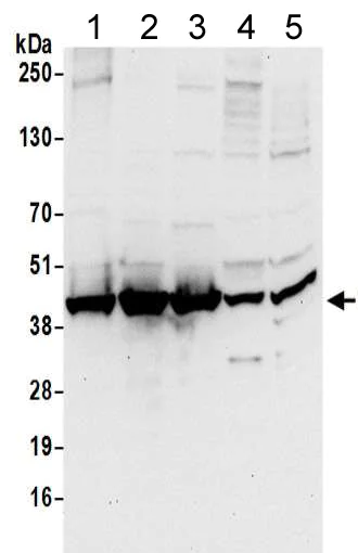 Western blot - Anti-Unrip antibody (AB205015)