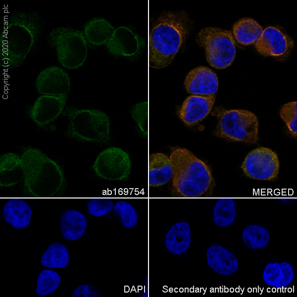 Immunocytochemistry/ Immunofluorescence - Anti-uPA antibody [EP6274(2)] (AB169754), expandable thumbnail