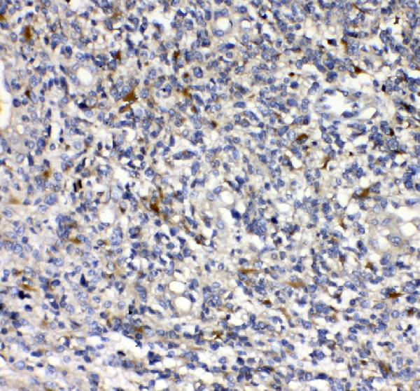 Immunohistochemistry (Formalin/PFA-fixed paraffin-embedded sections) - Anti-uPA Receptor/U-PAR antibody (AB103791)