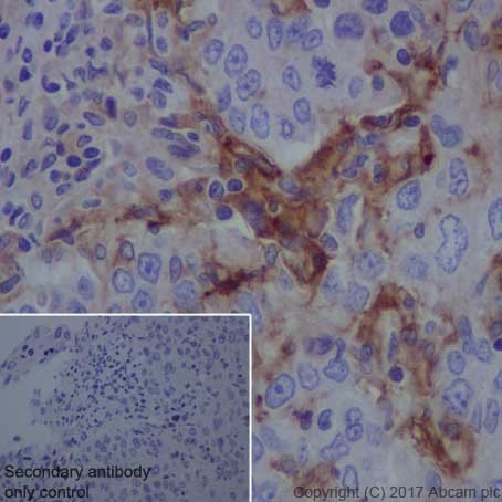 Immunohistochemistry (Formalin/PFA-fixed paraffin-embedded sections) - Anti-uPA Receptor/U-PAR antibody [EPR20191] (AB218106), expandable thumbnail