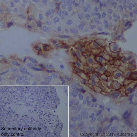 Immunohistochemistry (Formalin/PFA-fixed paraffin-embedded sections) - Anti-uPA Receptor/U-PAR antibody [EPR20191] (AB218106), expandable thumbnail