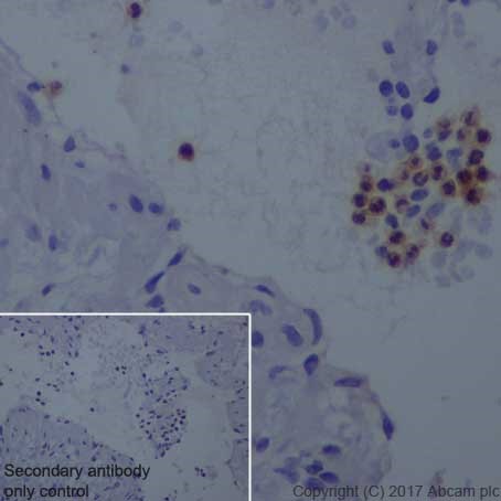 Immunohistochemistry (Formalin/PFA-fixed paraffin-embedded sections) - Anti-uPA Receptor/U-PAR antibody [EPR20191] (AB218106), expandable thumbnail