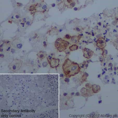 Immunohistochemistry (Formalin/PFA-fixed paraffin-embedded sections) - Anti-uPA Receptor/U-PAR antibody [EPR20191] (AB218106), expandable thumbnail