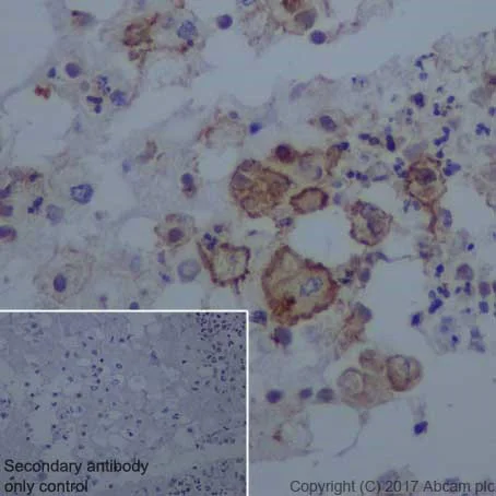 Immunohistochemistry (Formalin/PFA-fixed paraffin-embedded sections) - Anti-uPA Receptor/U-PAR antibody [EPR20191] (AB218106)