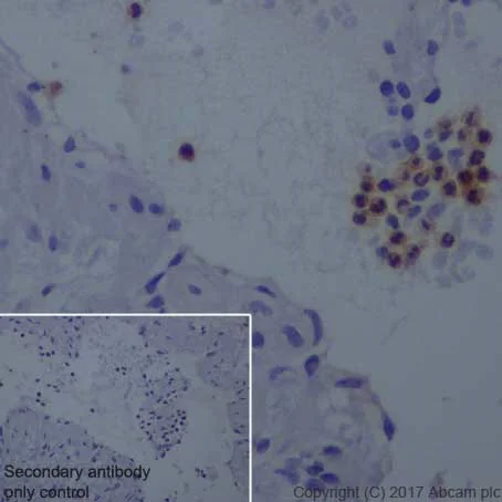 Immunohistochemistry (Formalin/PFA-fixed paraffin-embedded sections) - Anti-uPA Receptor/U-PAR antibody [EPR20191] - BSA and Azide free (AB251557)