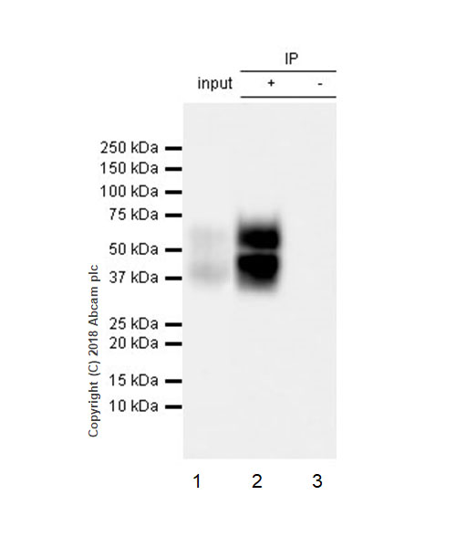 Immunoprecipitation - Anti-uPA Receptor/U-PAR antibody [EPR22173-257] (AB221680), expandable thumbnail