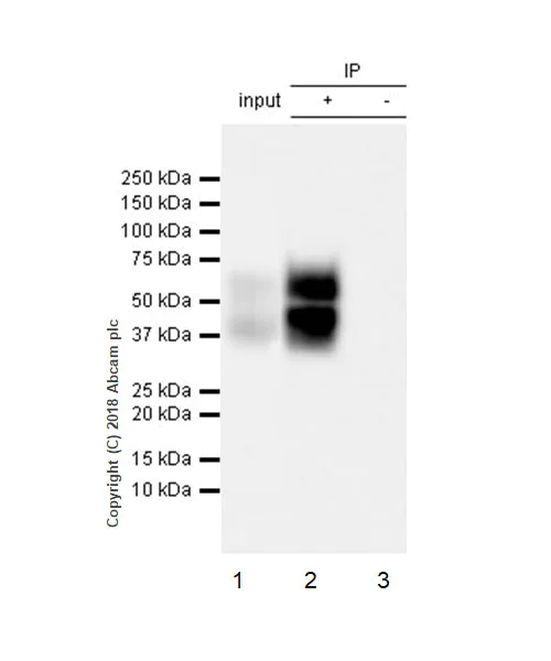 Immunoprecipitation - Anti-uPA Receptor/U-PAR antibody [EPR22173-257] - BSA and Azide free (AB240825)