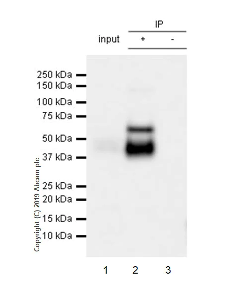 Immunoprecipitation - Anti-uPA Receptor/U-PAR antibody [EPR22814-273] - BSA and Azide free (AB256763)