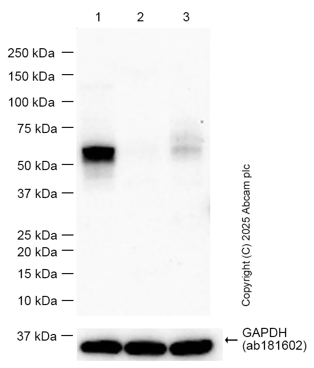 Western blot - Anti-uPA Receptor/U-PAR antibody [EPR22814-273] - BSA and Azide free (AB256763)