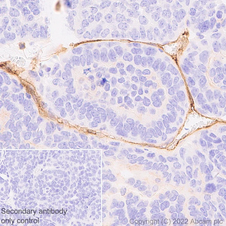 Immunohistochemistry (Formalin/PFA-fixed paraffin-embedded sections) - Anti-uPA Receptor/U-PAR antibody [EPR26916-73] - BSA and Azide free (AB307896)